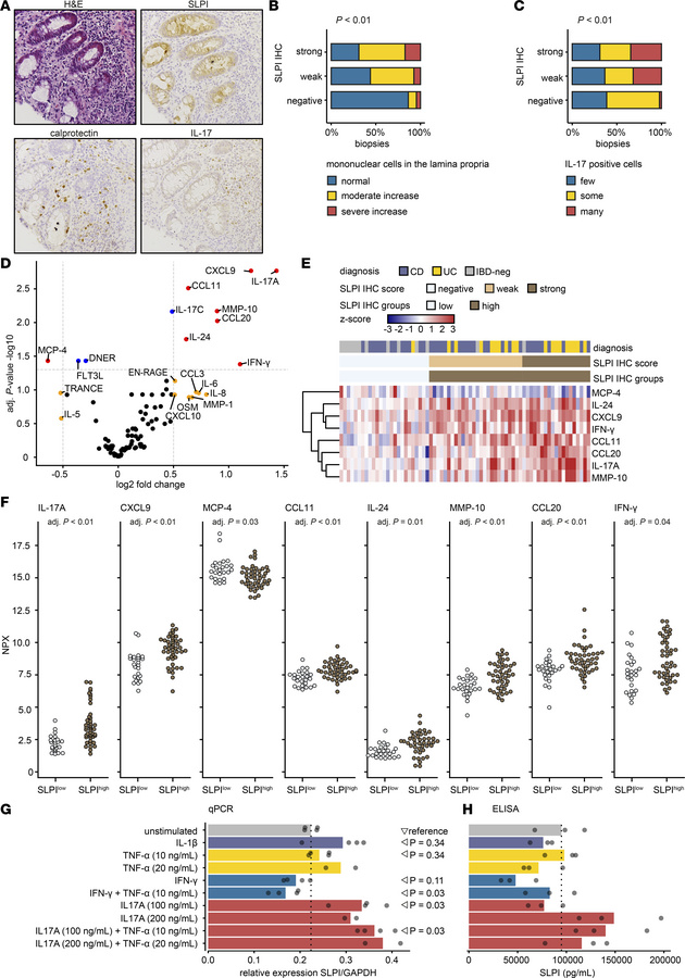 Colonic epithelial SLPI protein expression is associated with IL-17–posi...