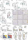SLPI expression is increased in colonic epithelium of therapy-naive pediatr