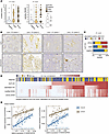 Colonic epithelial SLPI expression is associated with histological disease