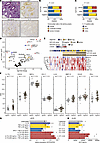 Colonic epithelial SLPI protein expression is associated with IL-17–positiv