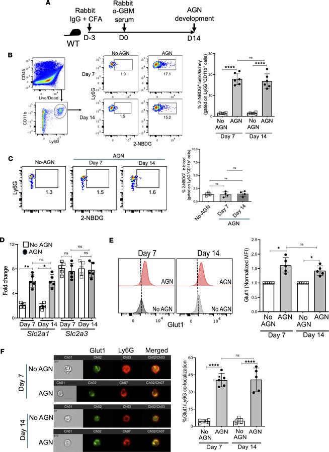 Kidney-infiltrating neutrophils upregulate Glut1-mediated glucose uptake...