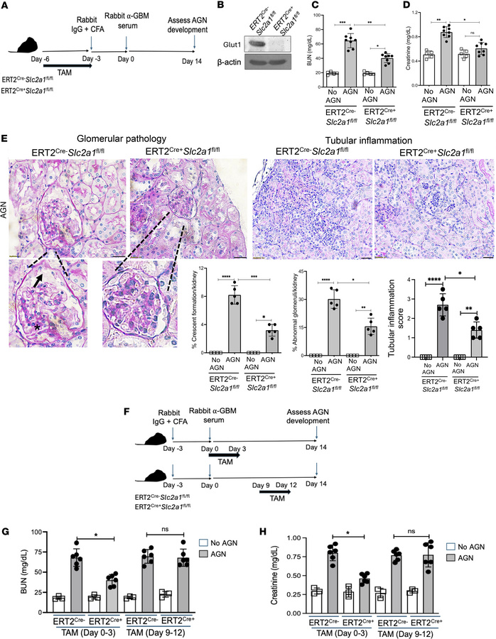 Glut1 plays a role in the pathogenesis of AGN.
(A) Schematic diagram of ...