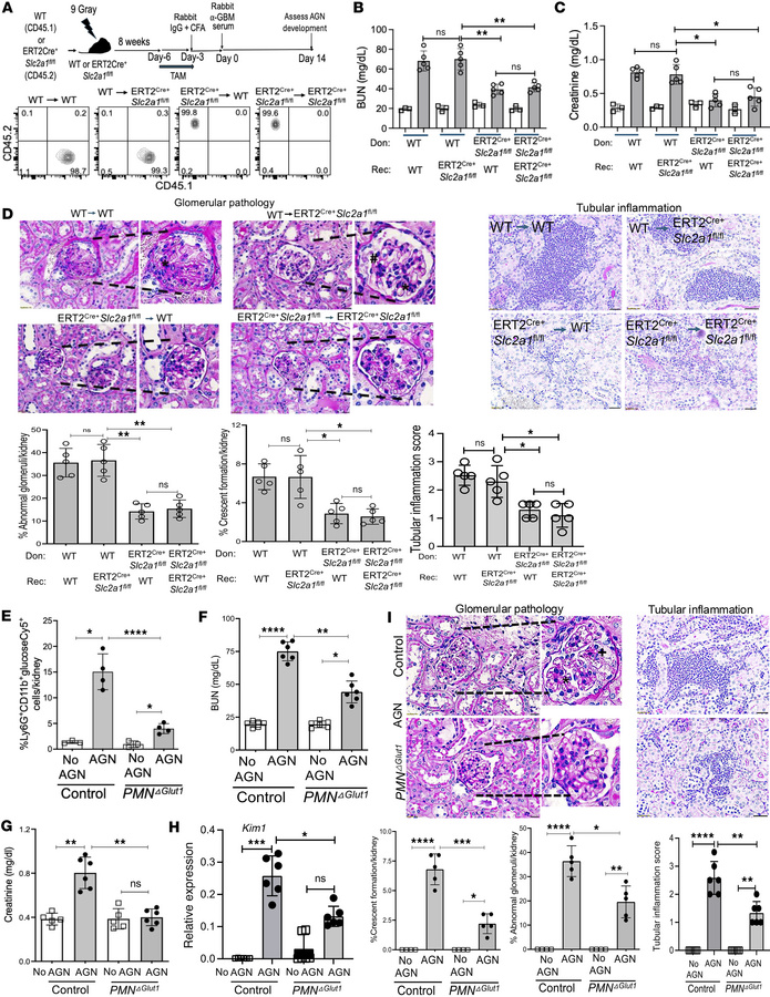 Neutrophil-specific Glut1 function reduces kidney damage in AGN.
(A) Sch...