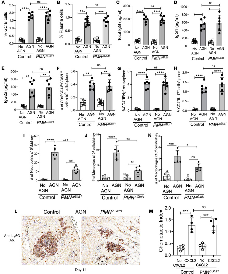 
PMNGlut1 mice show compromised kidney inflammatory response in AGN.
Con...
