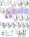 Glut1 inhibitor treatment ameliorates renal pathology in AGN.