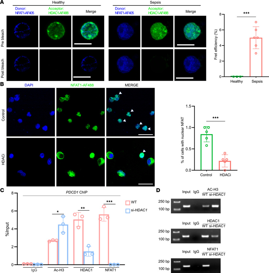 HDAC1 interacts with NFAT1 to promote its nuclear localization and trans...