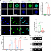 HDAC1 interacts with NFAT1 to promote its nuclear localization and transcri