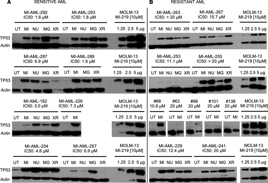 Results of TP53 immunoblotting in sensitive and resistant purified prima...