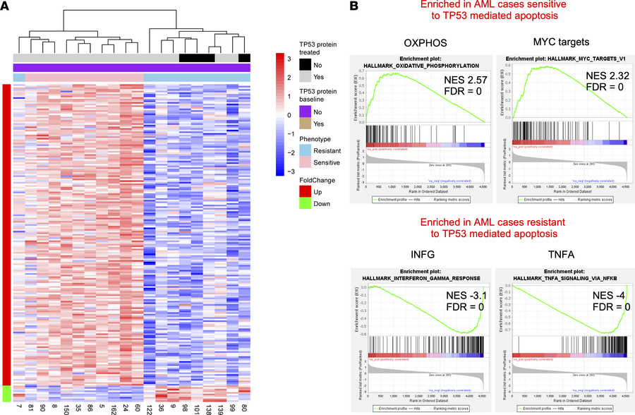 Substantial gene expression differences at baseline in primary human AML...