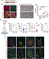 The p21+-β cell subpopulation was dysfunctional and lost its identity.