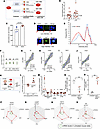 Secondary senescence: β cell SASP has non-cell-autonomous effects on neighb