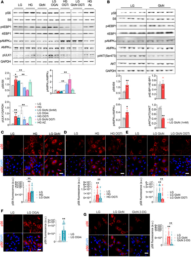 Regulation of mTORC1 by glucosamine in KPTCs.
(A and B) mTORC1 activity ...