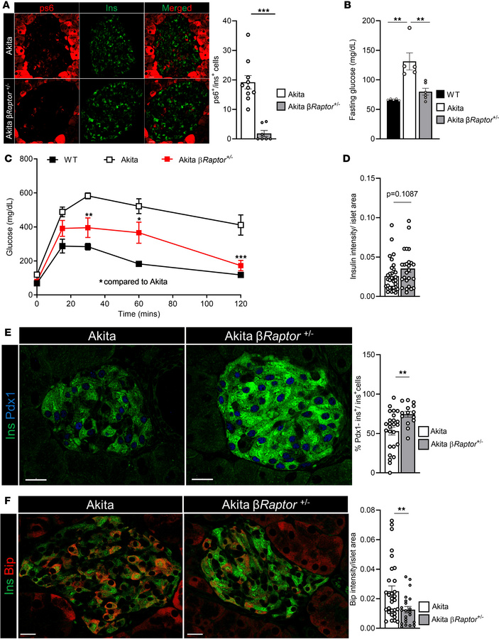 mTORC1 inhibition in Akita β cells improves diabetes and β cell function...