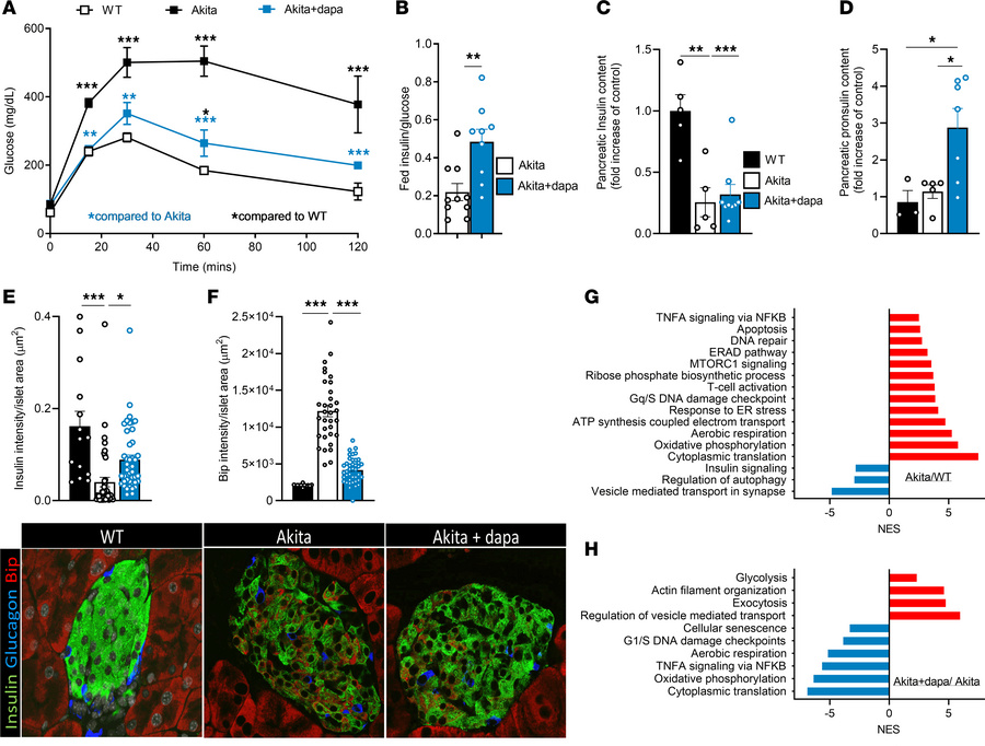 Dapagliflozin improves diabetes and β cell function, along with decrease...