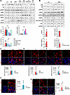 Regulation of mTORC1 by glucosamine in KPTCs.