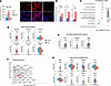 Effects of prolonged exposure to glucosamine on cellular stress and dysfunc