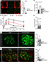 mTORC1 inhibition in Akita β cells improves diabetes and β cell function.