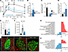 Dapagliflozin improves diabetes and β cell function, along with decreased E