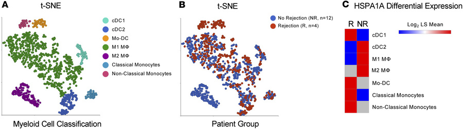 
HSPA1A expression in myeloid cells in rejecting human kidney allografts...