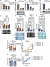 Estrogen-induced migratory phenotypes are abrogated by UGDH KD in ER+ and E