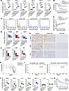 DNA delivered by LNP mediates the antitumor effect in HCC mouse model.