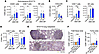DNA-LNP induces CD8+ T cell infiltration of tumor sites and immune cell act