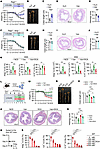 DCA impairs colitis remission by inhibiting colonic ILC2 function.