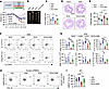 The PERK branch of UPR mediates DCA-inhibited ILC2 function and colitis rec