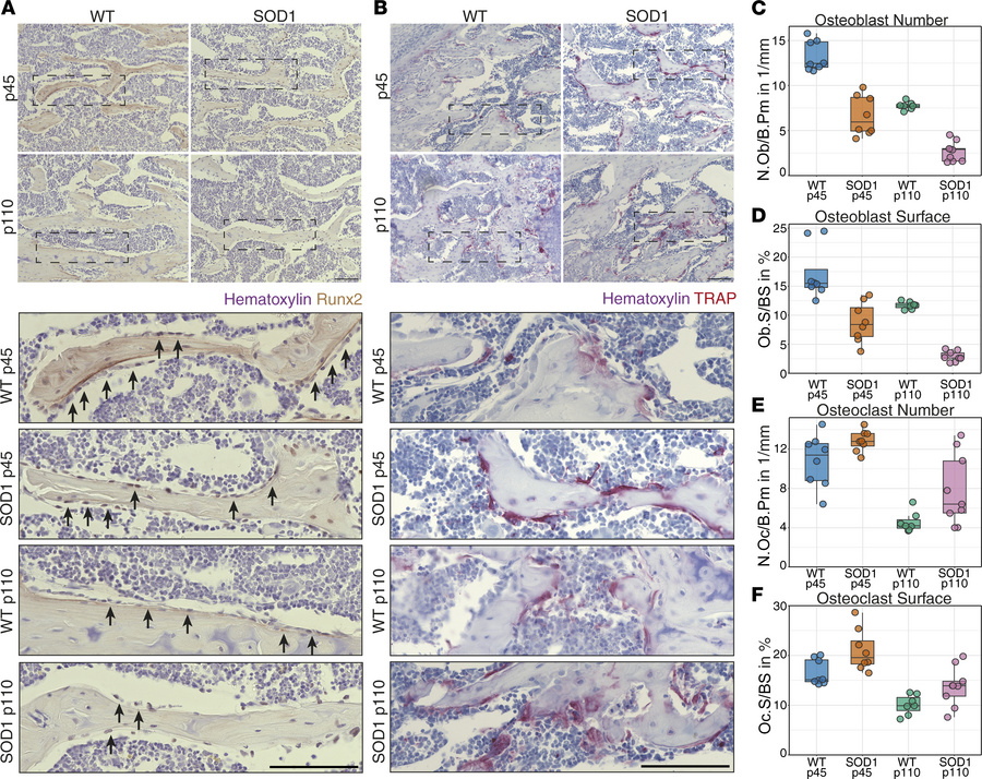 Imbalance of osteoblast and osteoclast cells in SOD1(G93A) mice at presy...