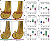 Early trabecular thinning and reduced mineralization precede cortical bone