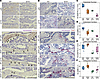 Imbalance of osteoblast and osteoclast cells in SOD1(G93A) mice at presympt