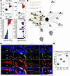 Transcriptomic alterations and cellular senescence in SOD1(G93A) bulk bones