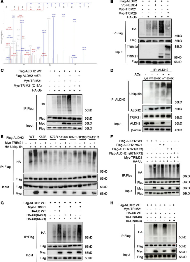 Ubiquitination of ALDH2 protein is mediated by E3 ligase TRIM21.
(A) TRI...