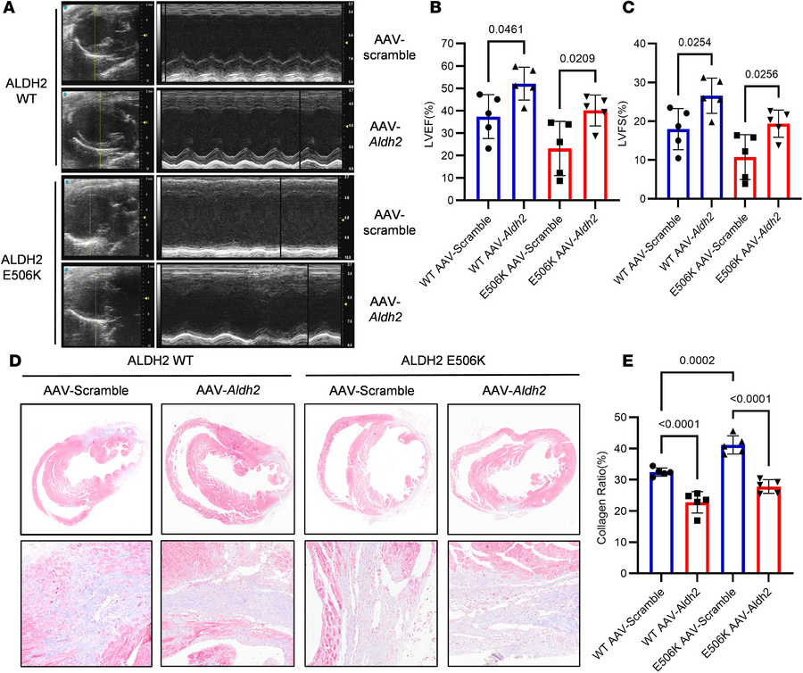 
Aldh2 overexpressing rescues worsened cardiac function induced by Aldh2...