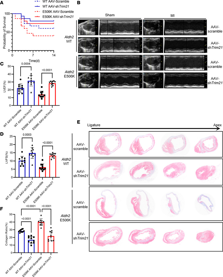 Macrophage-specific Trim21 downregulating ameliorates cardiac fibrosis o...