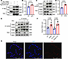 TRIM21 directly interacts with ALDH2.