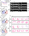 Macrophage-specific Trim21 downregulating ameliorates cardiac fibrosis owin