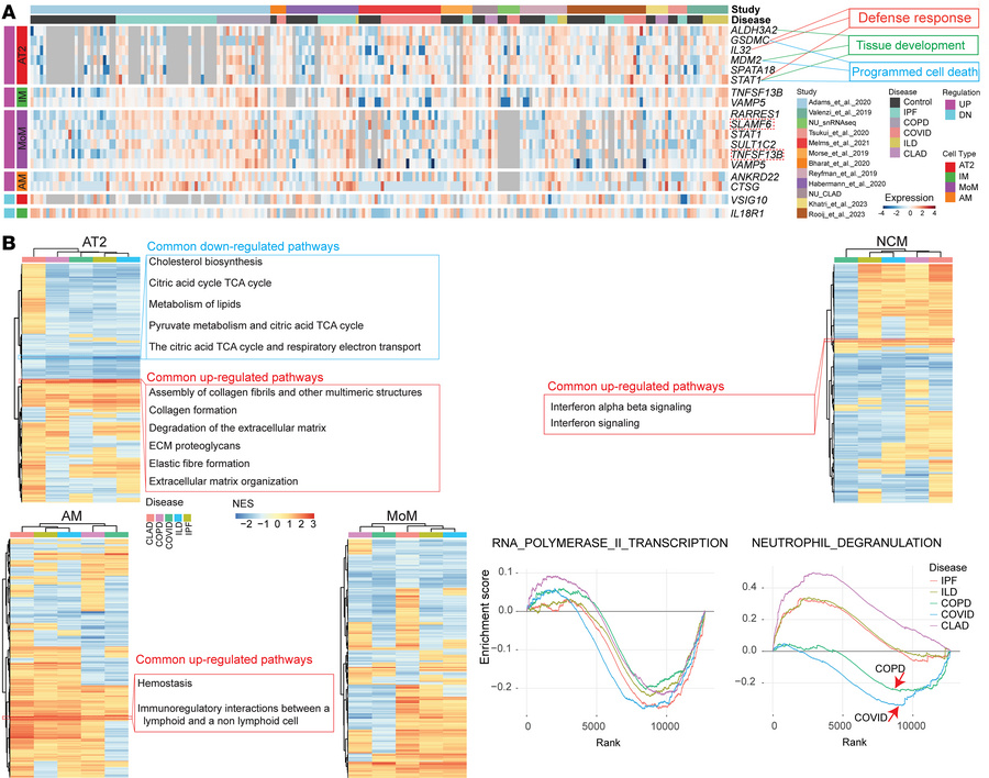 Shared molecular signature between CLAD and other disease etiologies.
(A...