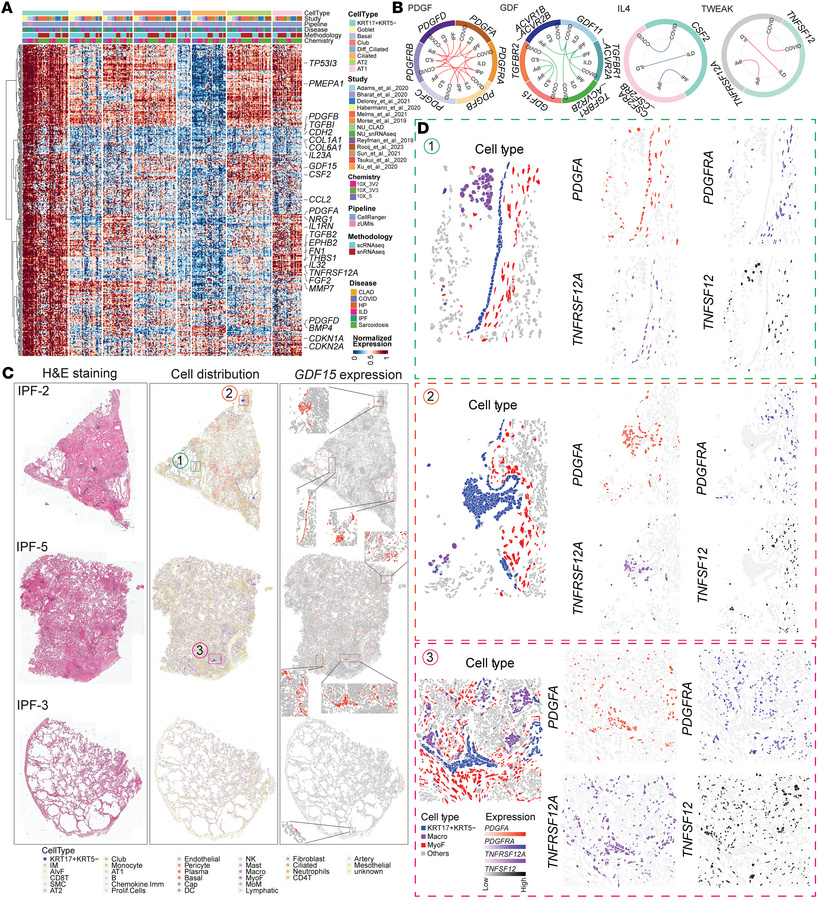 Core gene signature of KRT17+KRT5– cells regardless of disease states an...