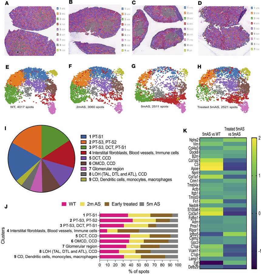 Spatial maps of kidney of AS mice injected with EVs.
(A–D) ST integrated...