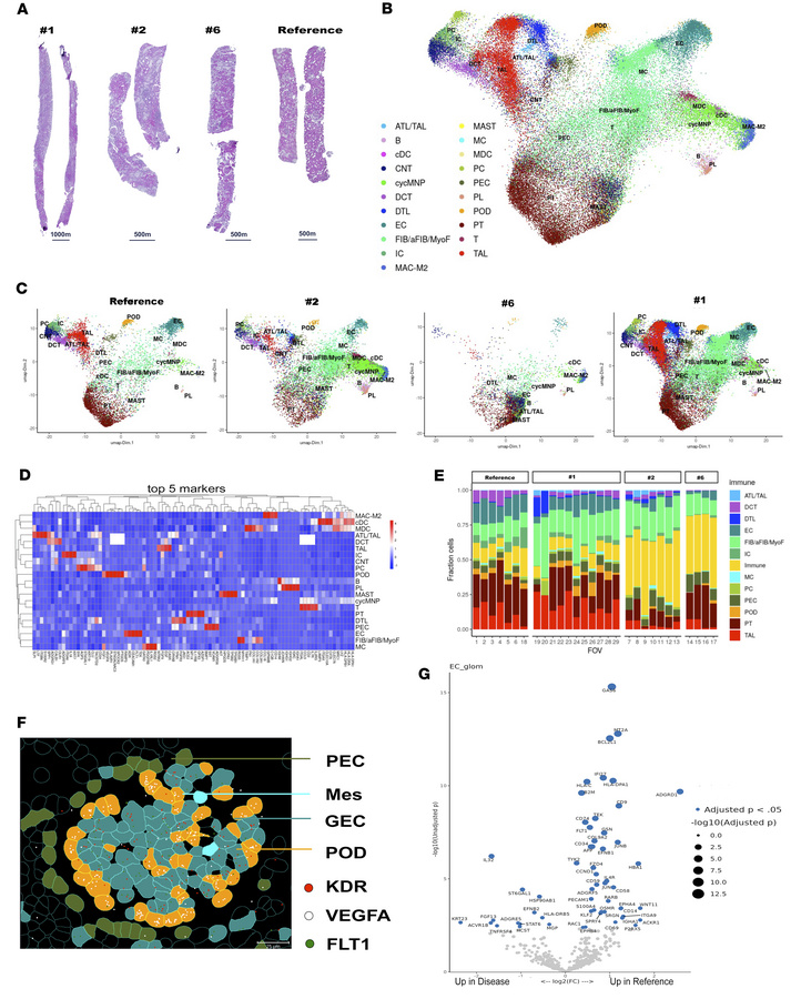 Spatial maps of AS biopsies.
(A) Histology micrographs from serially sec...
