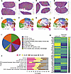 Spatial maps of kidney of AS mice injected with EVs.