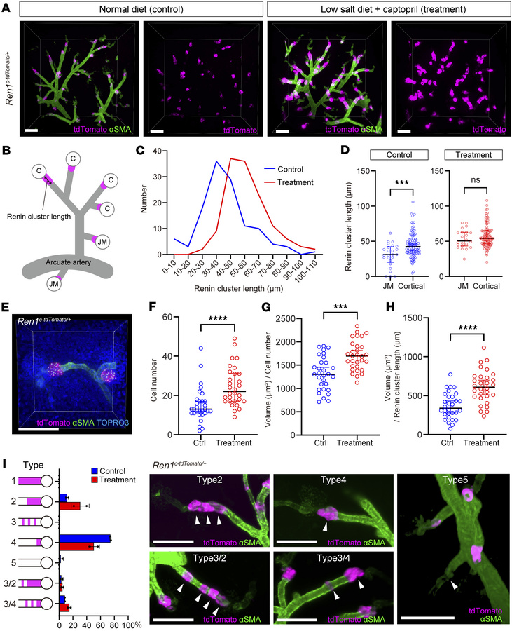 Acute physiological stress markedly alters the number, volume, and distr...