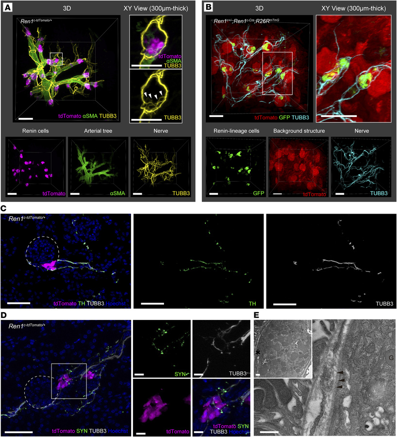 Dense sympathetic innervation of renin cell clusters in AAs.
(A) Three-d...
