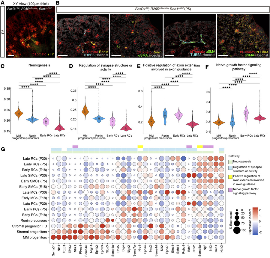 Stage-specific expression of axon guidance and neurotrophic factors by F...