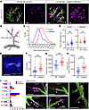 Acute physiological stress markedly alters the number, volume, and distribu