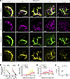 Spatiotemporal organization of renin cells and axonal growth trajectories a