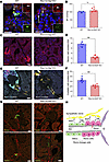 Renin cell–specific Ngf KO diminishes renin-lineage cells and their innerva