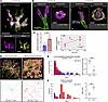 Renin enzymatic insufficiency leads to overstimulation of renin cells, NGF