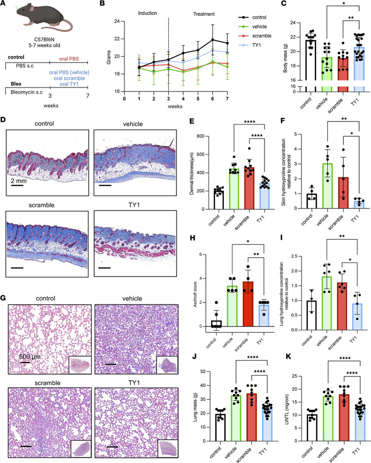 Therapeutic effects of TY1 in mice with skin thickening and SSc-like car...